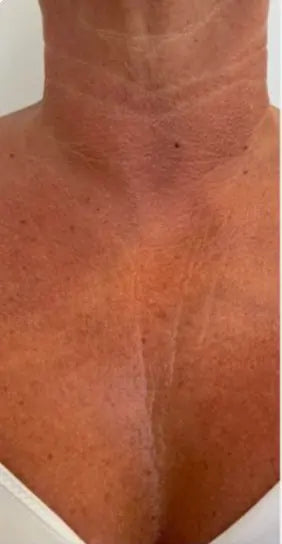 Décolleté avant
