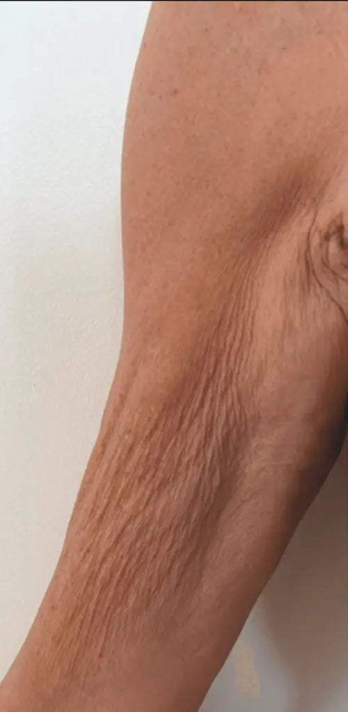 Peau avant